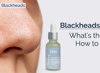 Blackheads vs. Whiteheads: What’s the Difference and How to Treat Them?